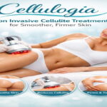 cellulogia